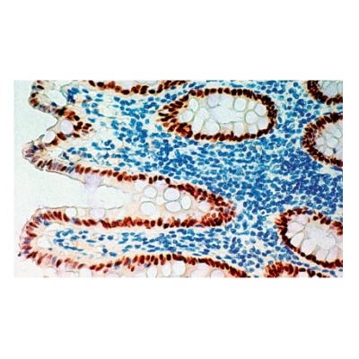 BioGenex Anti-CDX-2（现货热销中）