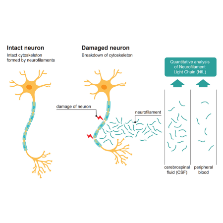 重组人Neurofilament L (NFL)蛋白 | Human Neurofilament L (NFL), 2-543 aa, His-tag