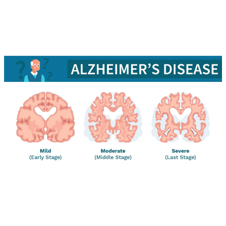 重组人Tau441蛋白 | Recombinant Human Tau441, phosphorylated