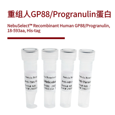 重组人GP88/Progranulin蛋白 | Human GP88/Progranulin, 18-593aa, His-tag