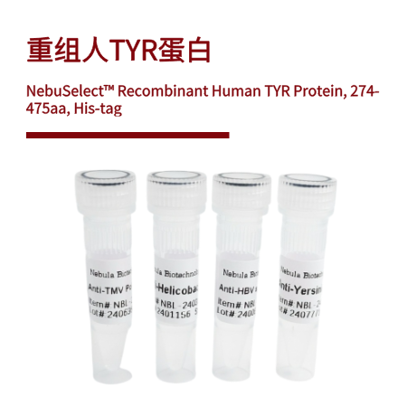 重组人TYR蛋白 | Recombinant Human TYR Protein, 274-475aa, His-tag