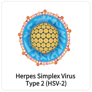 Herpes Simplex Virus Type 2 (HSV-2)