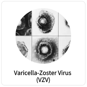 Varicella-Zoster Virus (VZV)