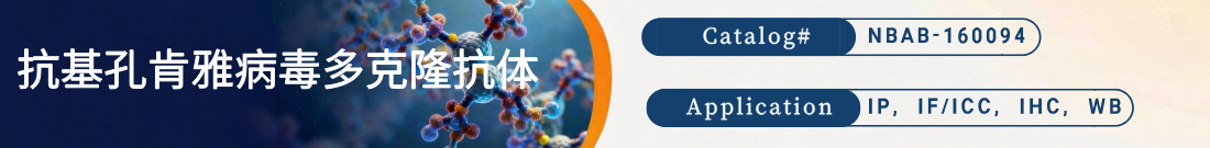 抗Chikungunya Virus, CHIKV抗体 抗Chikungunya Virus, CHIKV抗体