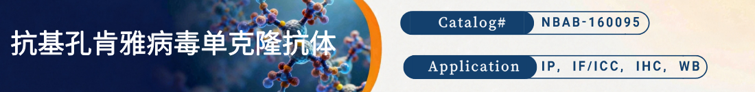 抗Chikungunya Virus, CHIKV抗体 抗Chikungunya Virus, CHIKV抗体