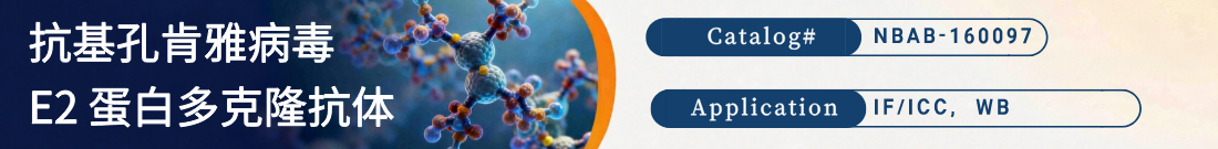 抗Chikungunya Virus E2, CHIKV抗体 抗Chikungunya Virus E2, CHIKV抗体