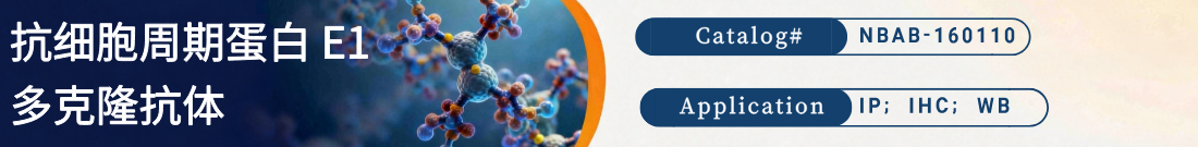 抗Cyclin E1抗体 | Anti-Cyclin E1 Polyclonal Antibody 抗Cyclin E1抗体 | Anti-Cyclin E1 Polyclonal Antibody