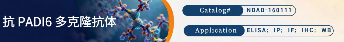 抗PADI6抗体 抗PADI6抗体
