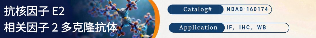 抗核因子E2抗体